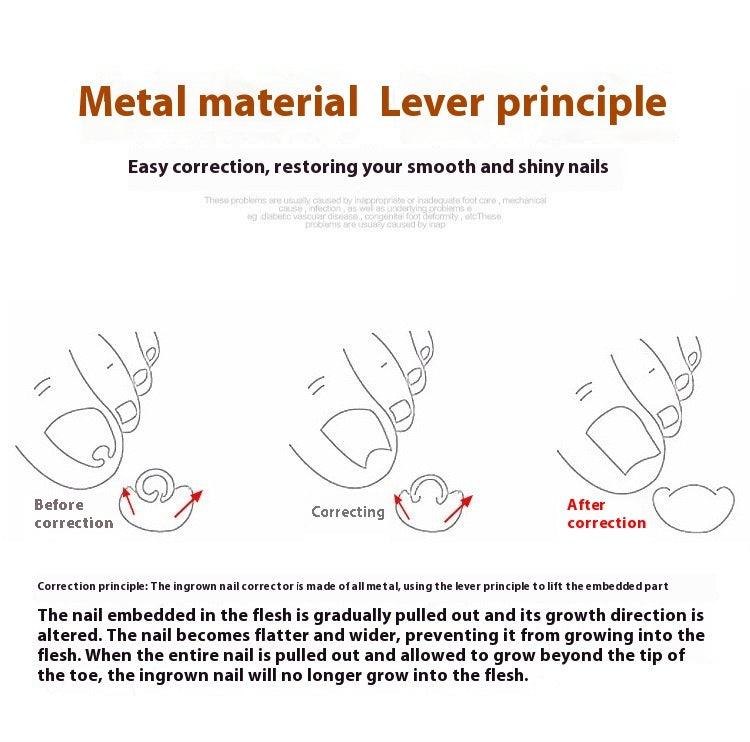 Nagelkorrektur-Set mit Werkzeugen