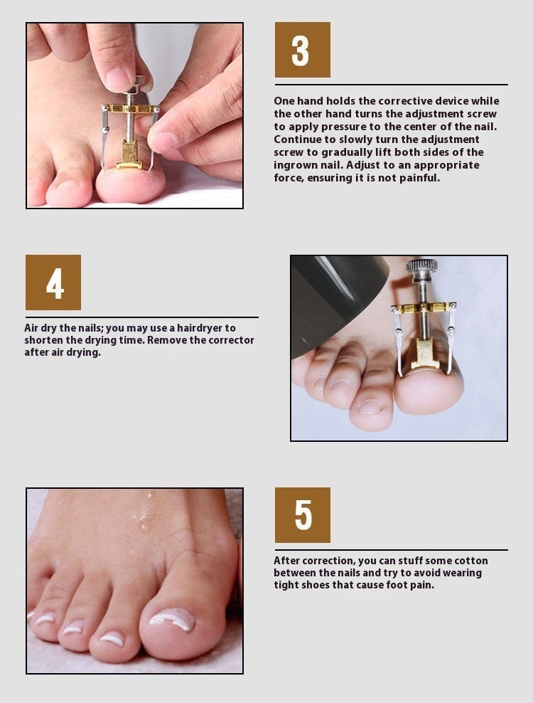 Nagelkorrektur-Set mit Werkzeugen