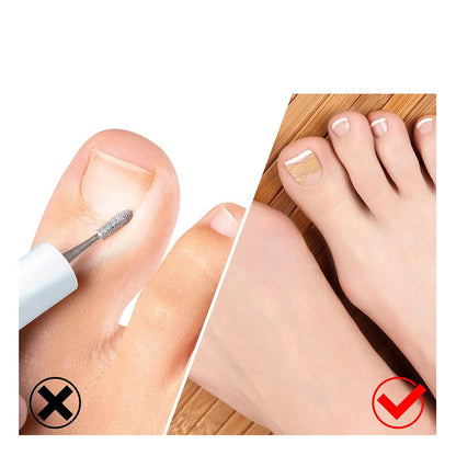 Nagelkorrektur-Set mit Werkzeugen