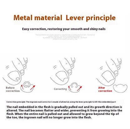 Nagelkorrektur-Set mit Werkzeugen